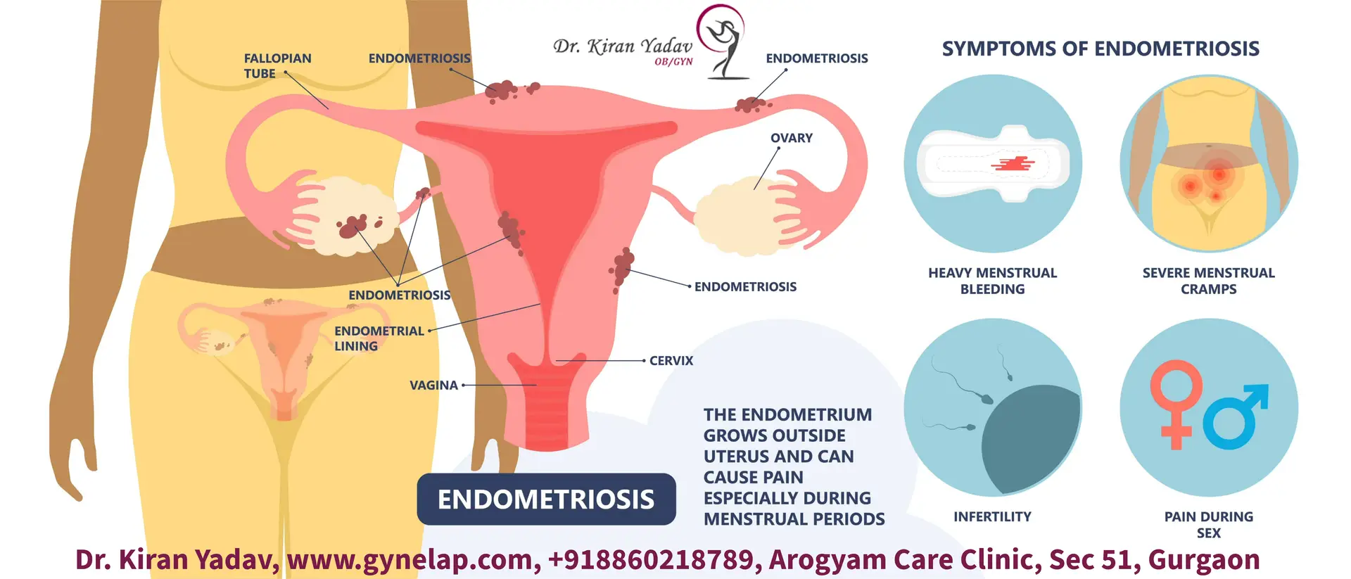 Read more about the article Gynecological Surgery: Types, Indications, and Recovery