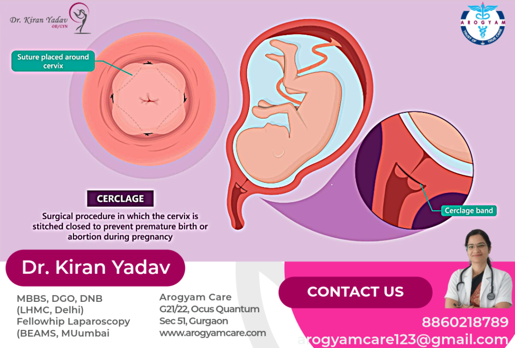 Cervical Stitch/ Cervical Cerclage