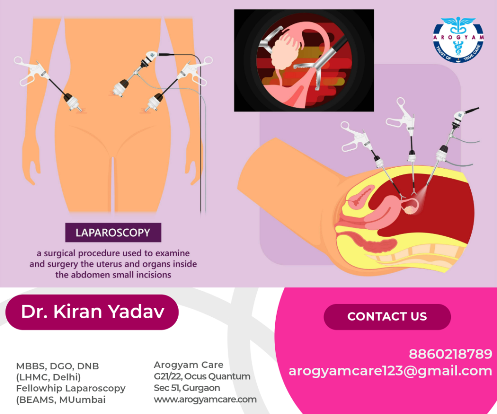 Laparoscopic Surgery , Laparoscopic hysterectomy