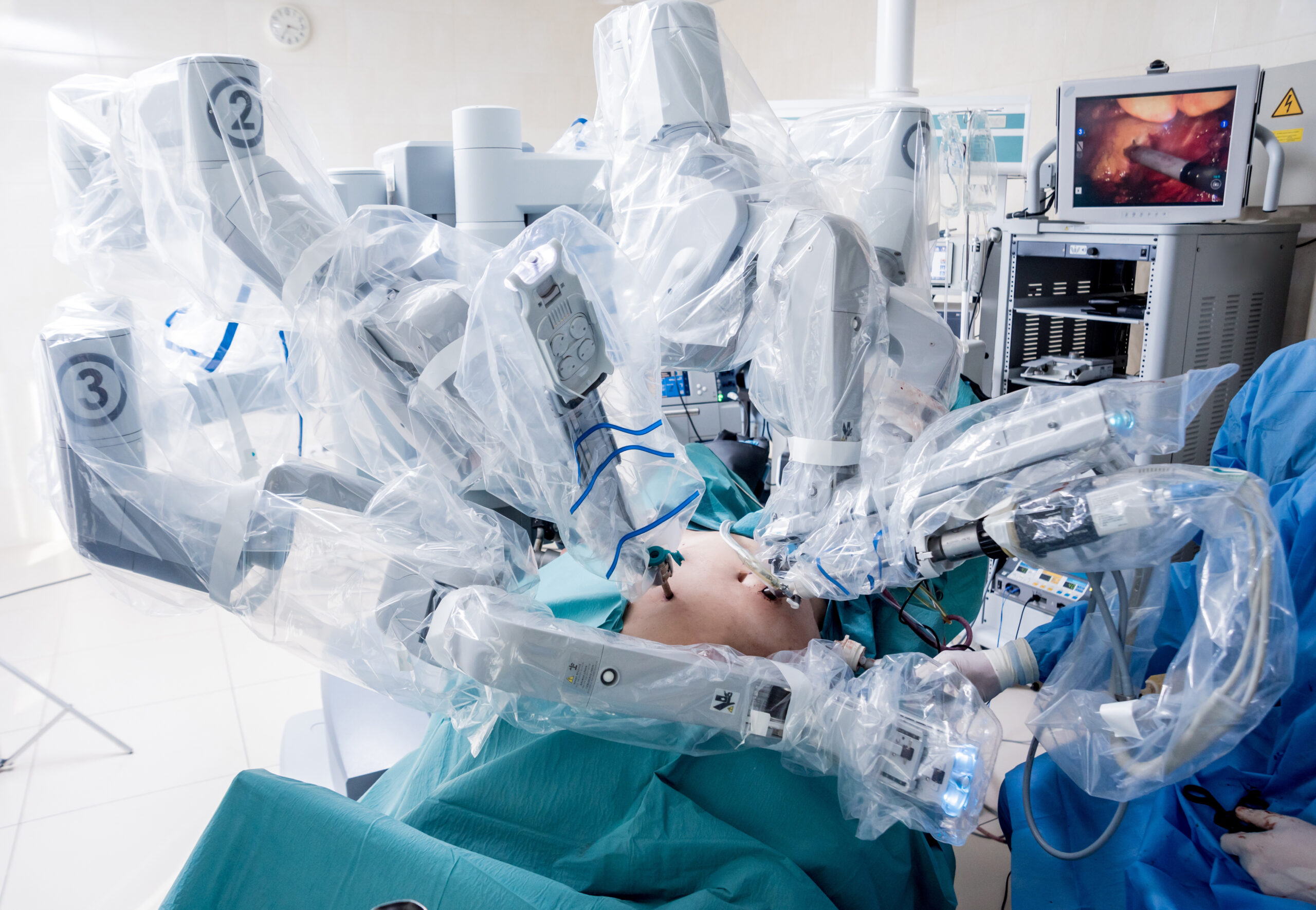 Robotic Gyne Surgery in Gurgaon