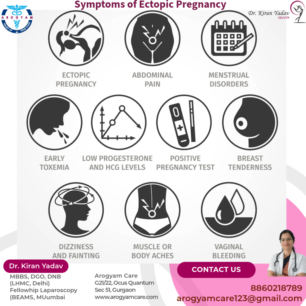 Symptoms of Ectopic Pregnancy