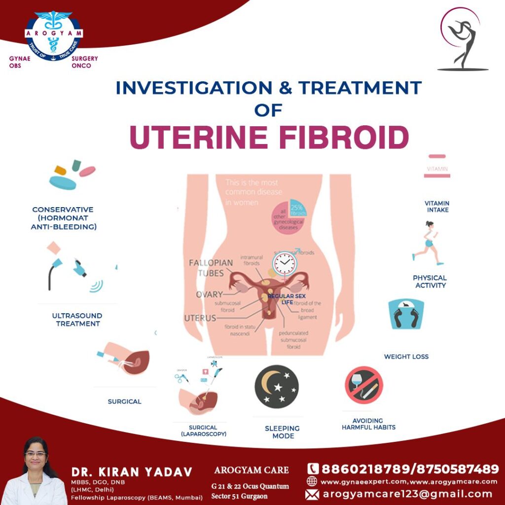 Treatment of Uterine Fibroid